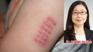 Japonya'da COVID-19 ölüm oranı neden düşük?