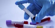 Corona testi yapılıyormu? Nerede
